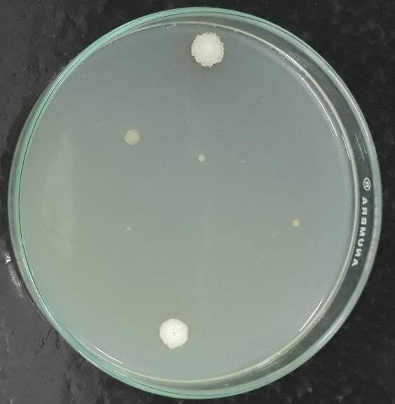 microbial sample